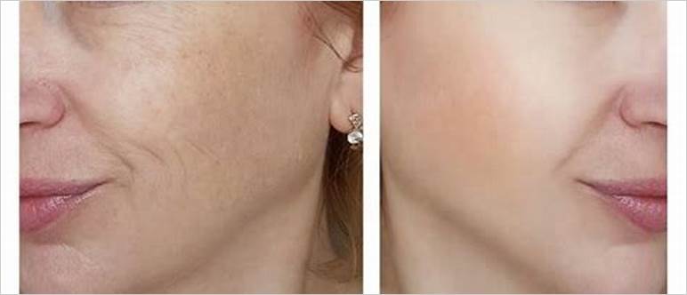 Best makeup foundation for wrinkled skin