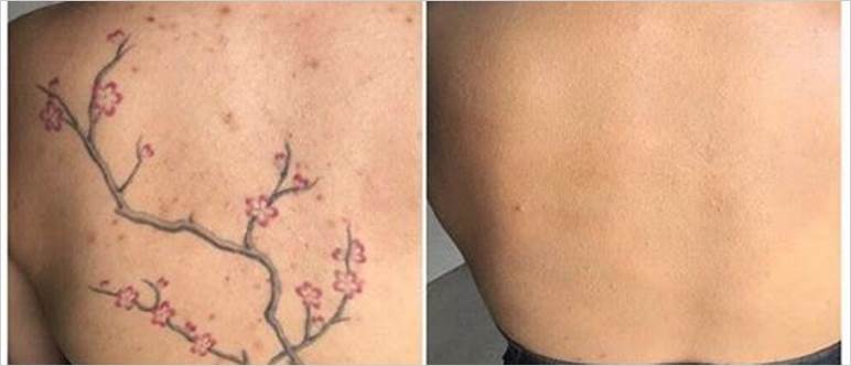 Tattoo cover makeup before and after